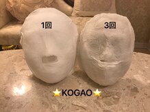 コガオ(KOGAO)/【効果実感】石膏パック×小顔