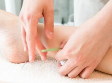 サロン ド ハリッシュ(Salon de HARISH)/足首にも鍼を刺し全身の血行促進