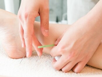 サロン ド ハリッシュ(Salon de HARISH)/足首にも鍼を刺し全身の血行促進