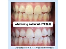 ホワイトニングサロン ホワイト(WHITE)/セルフホワイトニング/大阪/福島