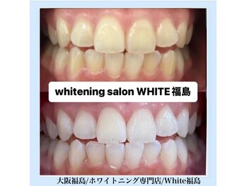 ホワイトニングサロン ホワイト(WHITE)/セルフホワイトニング/大阪/福島