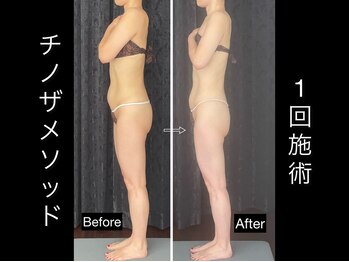 サザンベル 石垣店(SOUTHERN BELLE)/チノザメソッド