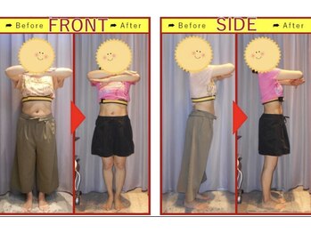 栄光治院 安城院/痩身ビフォーアフターブログ掲載