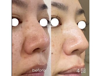 ランポ(lampo)/Lit 4回目