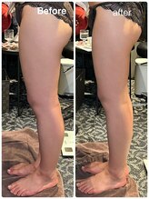 ルミネル 名古屋新栄(Luminelle)/太もも