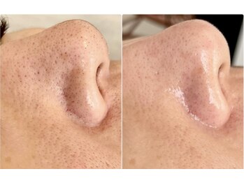 ジン フォー ユアビューティー(JIN for your beauty)/施術経過