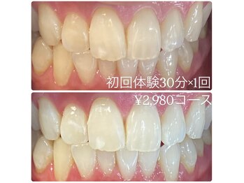 ホワイトニングルーム 横浜店(Whitening Room)/セルフホワイトニング/横浜