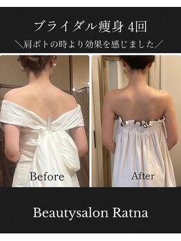 ラトナ(Ratna)/ブライダル痩身4回