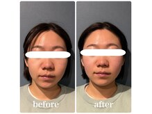 フィジオリハ 久屋大通店の雰囲気(フェイスラインやお顔の左右差もソフトなタッチで改善★)