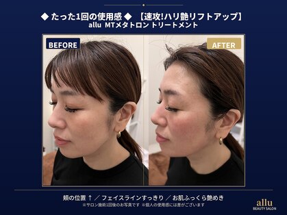 アル 本町店(allu)の写真
