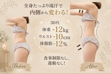 ヨサパーク メル(YOSA PARK mer)