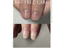 フィグ ツリー(fig tree)
