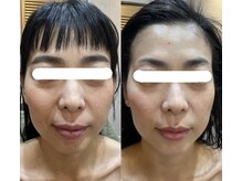 トゥーリ 春日店(tuuli)/ビフォーアフター