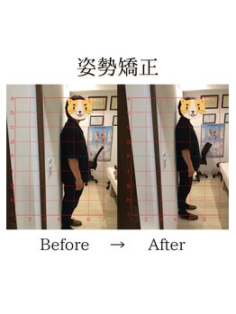心斎橋長堀フェムテック整骨院/13姿勢矯正　骨格矯正と骨盤矯正