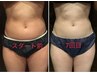 【腰の贅肉撃退◎】Wキャビ×EMS ウエスト集中30分→¥4200
