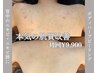【ボディのニキビケア！】剥けないボディハーブピーリング￥8,800