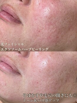 サロン ド マキ(Salon de Maki)/大人男性向け本気の肌管理!