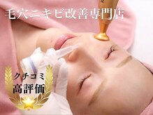 イリゼ(iriser)の雰囲気（毛穴洗浄×ハーブピーリングでW効果！繰り返すニキビケアに◎）