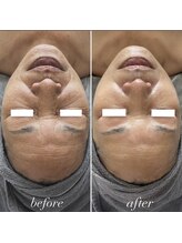 エクラ(eclat)/別人級！！