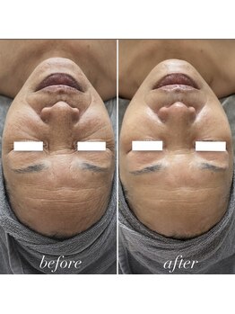 エクラ(eclat)/別人級！！