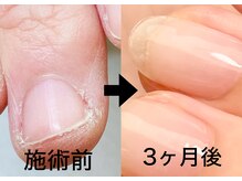 ネイルサロン ミノアッカ(mino'aka)
