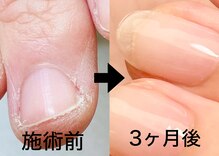 ネイルサロン ミノアッカ(mino'aka)