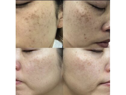 サロン 398(salon 398)の写真