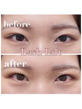 アイル バイ エドゥース(I'LL by et Douce)/厚みのある瞼もぱっちりと♪