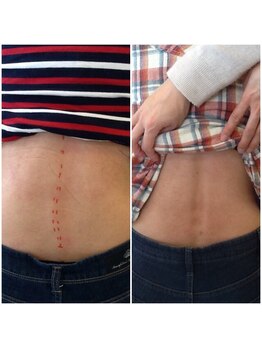 土井接骨院 本店/整体バキボキマッサージではムリ