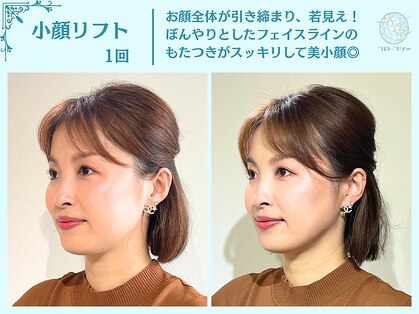 フローフシ∞の写真