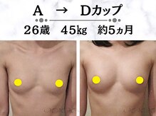 メディカルサロン エム エム エム 大阪梅田グランドサロン(M.M.M)の雰囲気（ボリュームUP技術が豊富！寄せ集めるのではなく内側からバストUP）