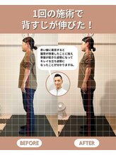 スペックフィジカルコンディショニング(SPECフィジカルコンディショニング)/30代女性/姿勢ビフォーアフター