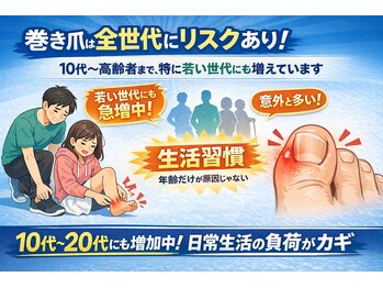 巻き爪じゅん 千葉駅前店/巻き爪は年齢より〇〇が原因？