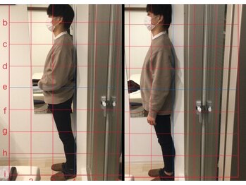 心斎橋長堀フェムテック整骨院/3　姿勢矯正　整体