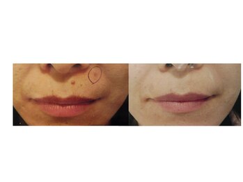 エムズ(M’s)/結果が良く出ています。