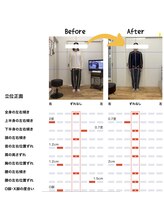 篠丸接骨院/◎施術実績◎O脚が真っ直ぐに！