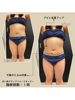 スパチャーレ(Spa ciare)/フォースカッター 90分