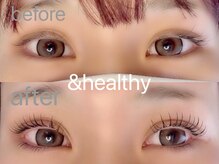 アネロ 千葉東船橋店(anello)/＆healthy120本