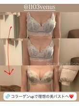 ヴィーナス(Venus)/バストアップ（痩身効果◎整体◎