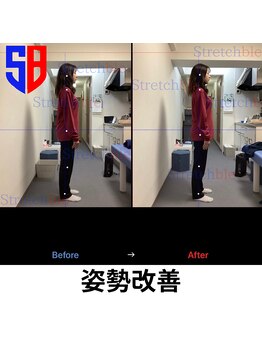 ストレッチブル 根津店(Stretchble)/姿勢のビフォーアフター