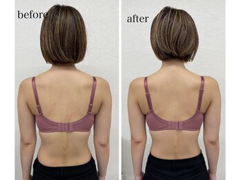 ルミエール(Lumiere)/【倉敷市】バストアップ施術事例