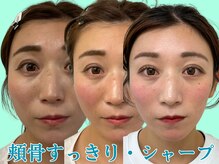 ナチュラルパーフェクトフェイス 新宿