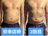 男性人気No.1★【痩身】ハイパーナイフ1部位+ウェーブ(EMS) 60分 ¥8,800