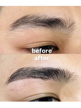 ケープラス(K Plus+)/before→after