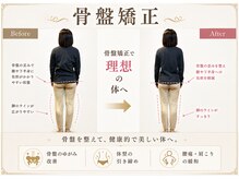 練馬アカデミア美容整体院/練馬姿勢矯正骨盤矯正ダイエット