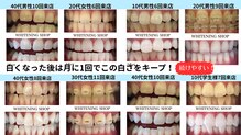 ホワイトニングショップ 熊谷店