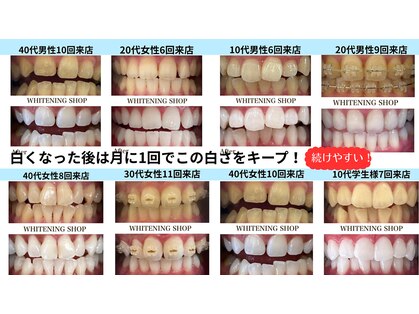 ホワイトニングショップ 熊谷店の写真
