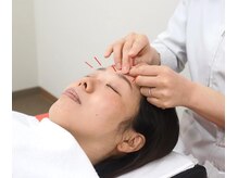 ほねつぎ 平成けやき通り鍼灸接骨院/眼の疲れにもおススメです♪