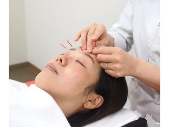 ほねつぎ 平成けやき通り鍼灸接骨院/眼の疲れにもおススメです♪