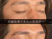 ユー 千葉駅前店(you)/ビフォーアフター写真